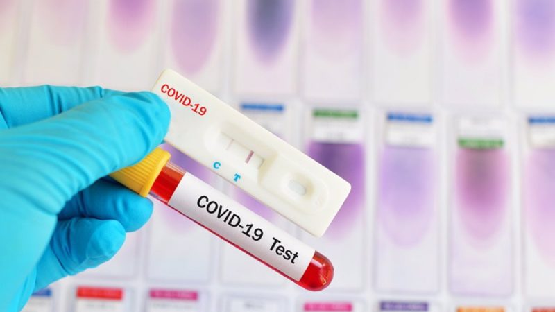 Pruebas del coronavirus, test Covid-19
SALUD
JARUN011/GETTY