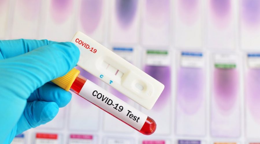 Pruebas del coronavirus, test Covid-19
SALUD
JARUN011/GETTY
